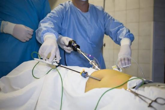 Shock Wave Lithotripsy